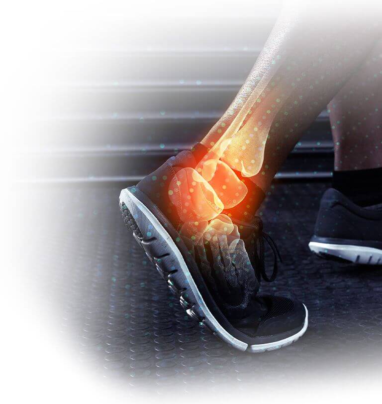 ankle-joint-replacement-optim