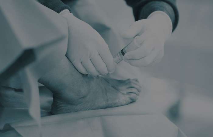 ankle-joint-arthroscopy-header-optim-1 ankle-joint-arthroscopy-header-optim-1