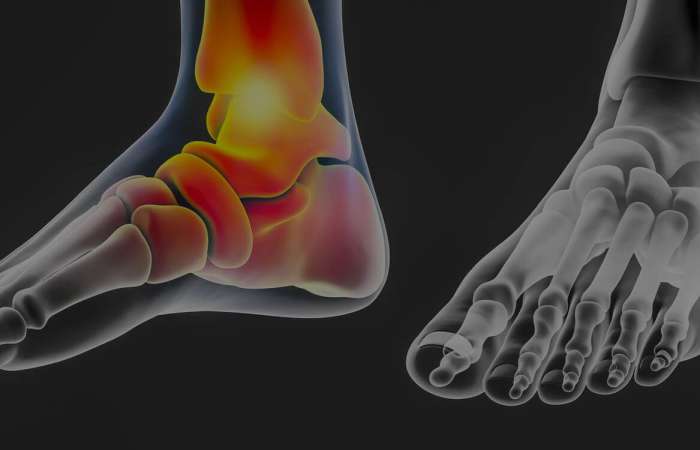 foot-ankle-revisions-and-second-opinions-header-optim foot-ankle-revisions-and-second-opinions-header-optim
