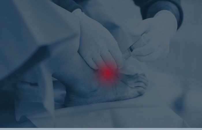 Ankle Joint Arthroscopy12 Ankle Joint Arthroscopy12