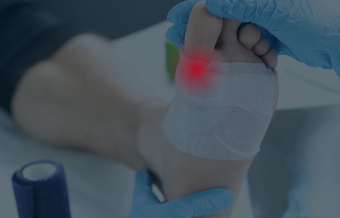 Wound Care17 Wound Care17