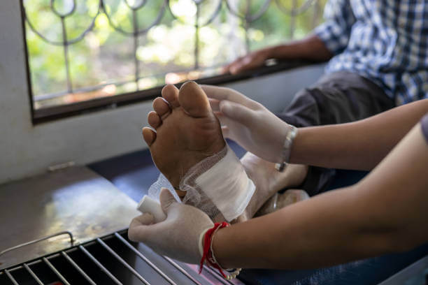 A close-up view of a female nurse wrapping a cloth over an elderly foot wound inside a health center in rural Thailand.