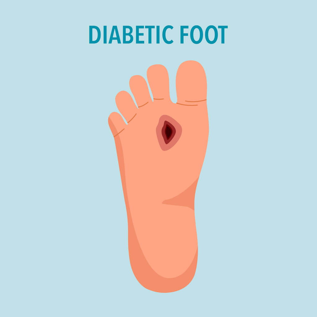 How To Find Relief from Diabetic Foot Pain - Foot & Ankle Institute of ...