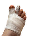 Bandaged foot after hammertoe surgery